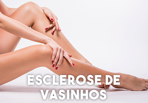 Esclerose-de-Vasinhos Esclerose-de-Vasinhos