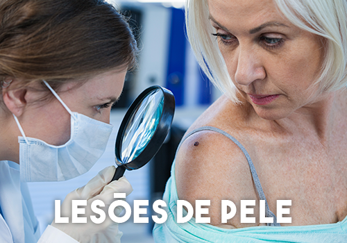 Lesões-de-Pele Lesões-de-Pele