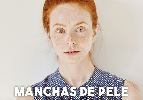 Manchas-de-Pele Manchas-de-Pele